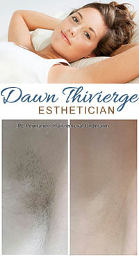 Dawn Thivierge