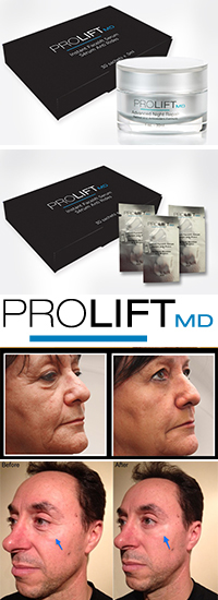 Prolift MD