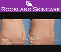 Rockland Skincare