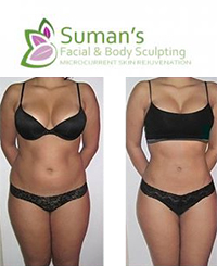 Suman's Facial & Body Sculpting