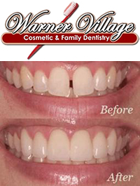 Warner Village Cosmetic & Family Dentistry